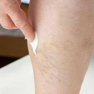 Zmniejsza widoczność żył